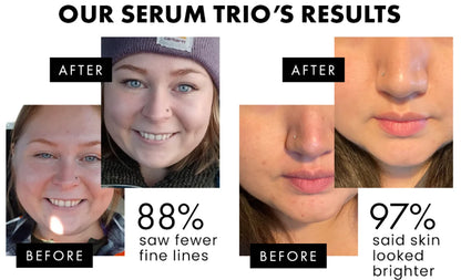 Facial Serums Skin Care Set  Moisturizing Retinol +Hyaluronic Acid + Vitamin C Serum Brightening Firming, & Hydrating Face Serum