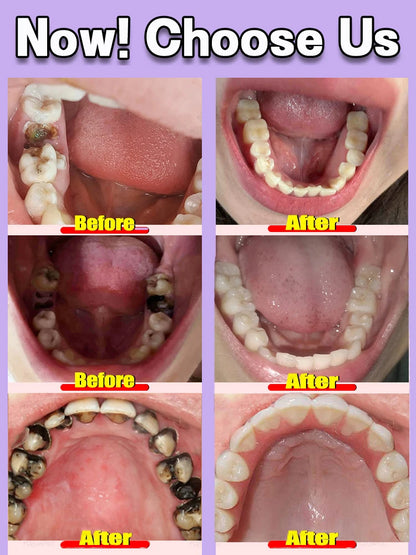 Solve all dental problem tooth decay repair tooth repair fast teeth whitening clean teeth teeth repair cavities