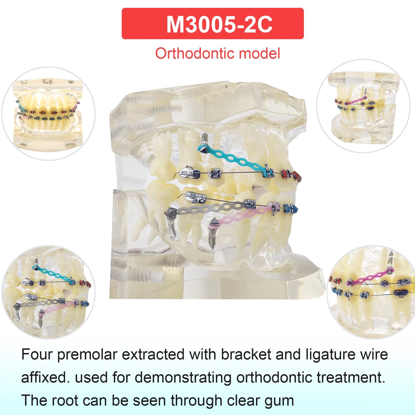 Dental Teeth Model Dental Teaching Models Implant Model Removable Dentistry Model Teeth For Training Studying Patient Education