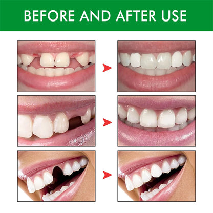 Teeth Solid Glue Resin Tooth Solid Gel with 3 Dental Tools Teeth Replacement Kit Disposable for Fix The Missing Broken Tooth