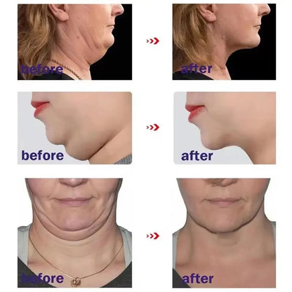 Roller Massager V-Shape Firming Face-lift Slimming Cream Removal Masseter Muscle Double Chin Face Fat Burning Anti-aging Product