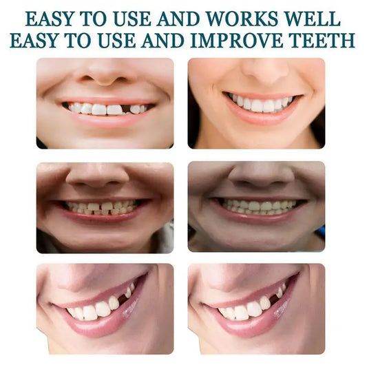 Fake Teeth Veneers Detachable And Reusable Veneers Teeth Teeth With Comfortable Fit Temporary Teeth Dentures Fake Tooth For