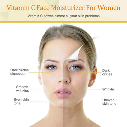 Vitamin C Cream, Vitamin C Face Cream With Nicotinamide & Hyaluronic Acid,