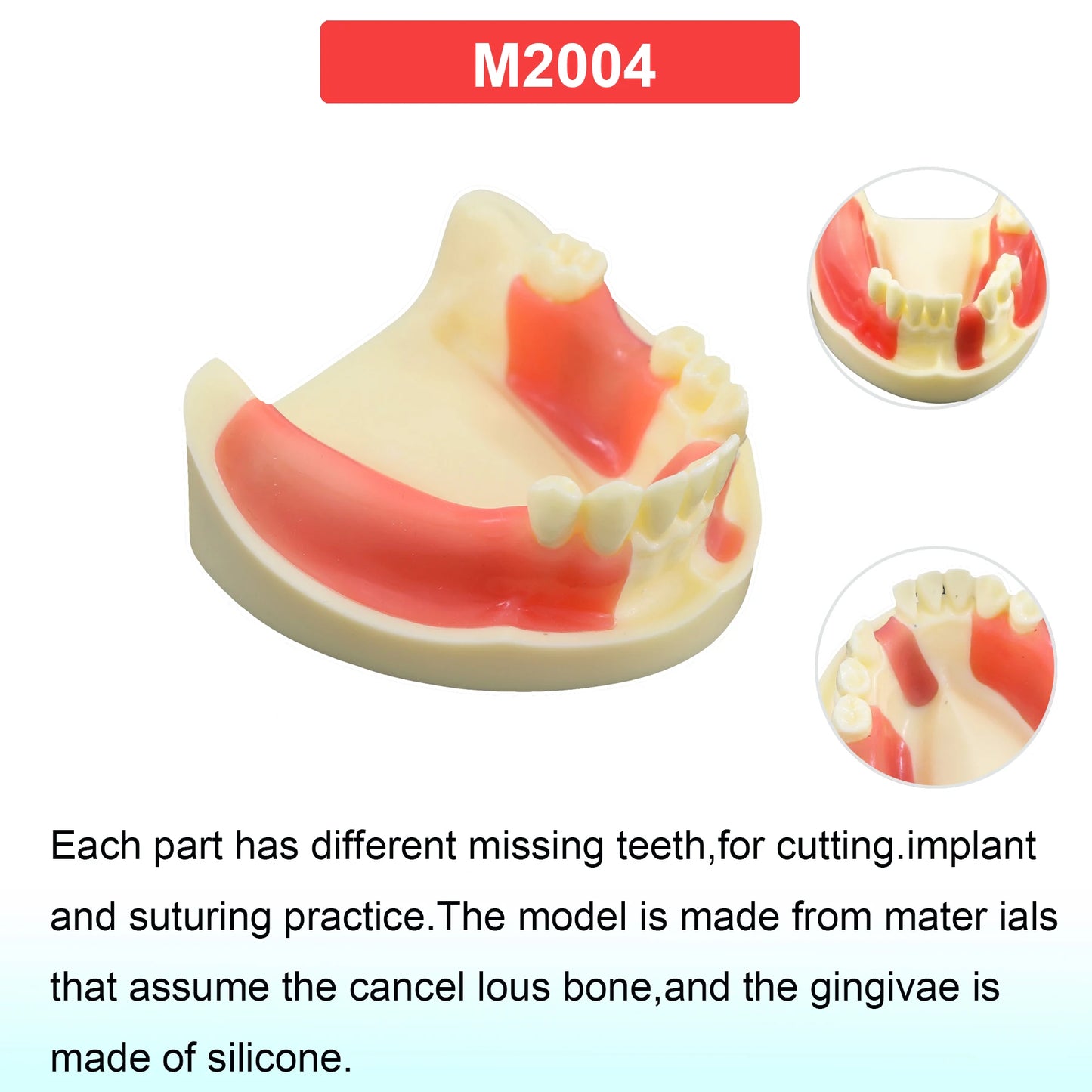 Dental Teeth Model Dental Teaching Models Implant Model Removable Dentistry Model Teeth For Training Studying Patient Education