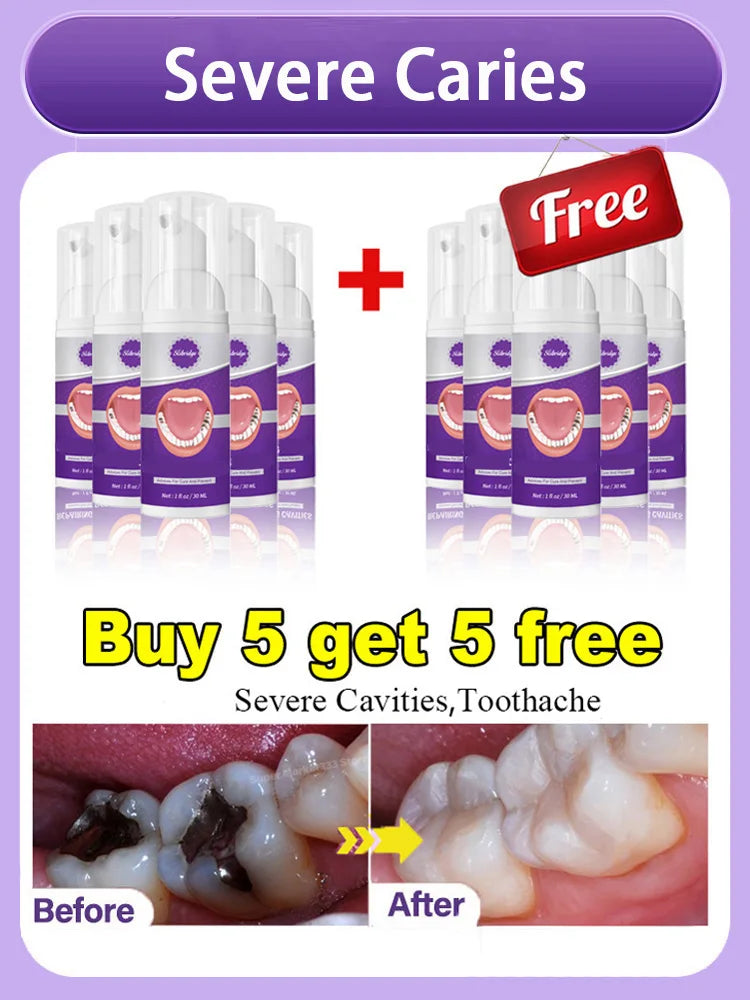 Solve all dental problem tooth decay repair tooth repair fast teeth whitening clean teeth teeth repair cavities
