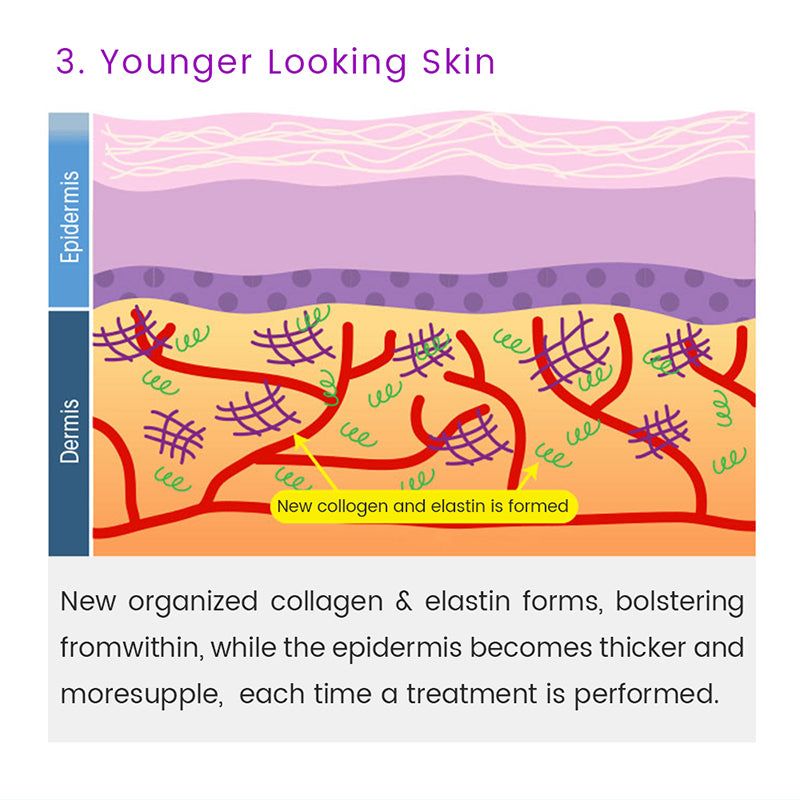 Facial Microneedle Roller Massage DRS 540 Derma Roller Needle Instrument Face Roller Massager Needles Skin Care Tool for Face