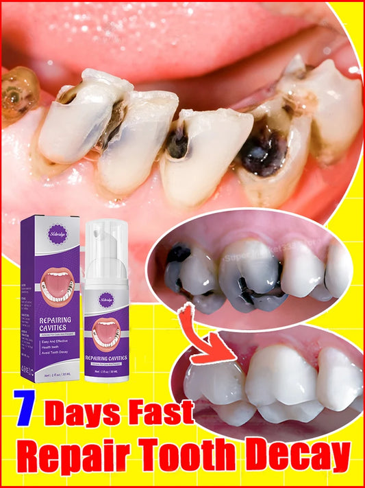 tooth decay repair tooth repair fast teeth whitening clean teeth teeth repair cavities tooth repair treatment