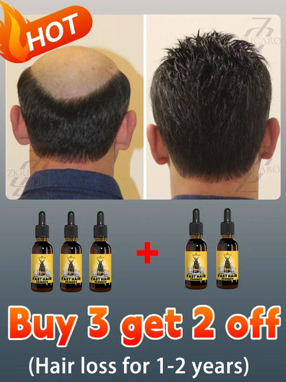 2025 Hair growth oil, repair baldness, hairline, rapid hair growth hair growth oil for men