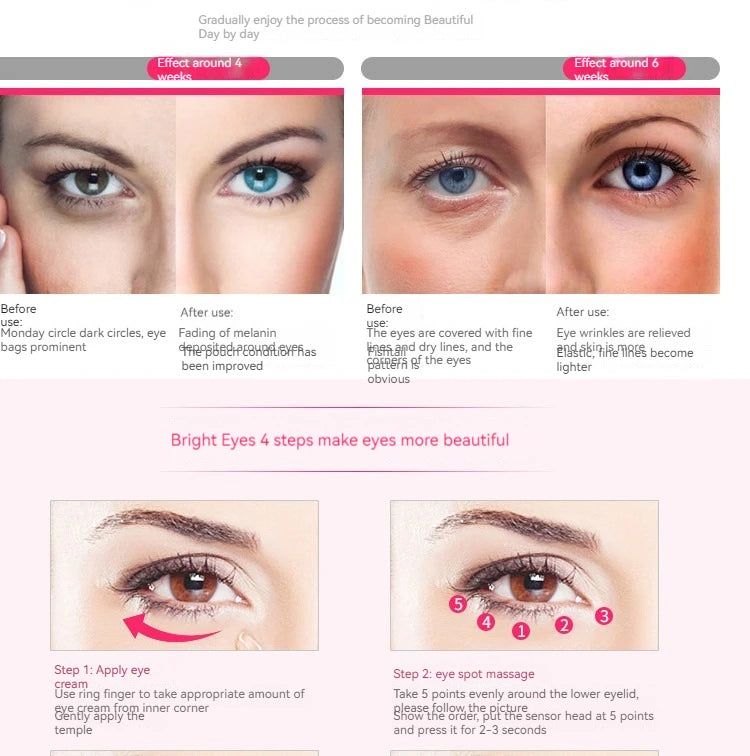 Home Electric Eye Massage Beauty Instrument Exquisite Eye Skin De-Bagging De-Watering Reduce Fine Lines Care Instrument