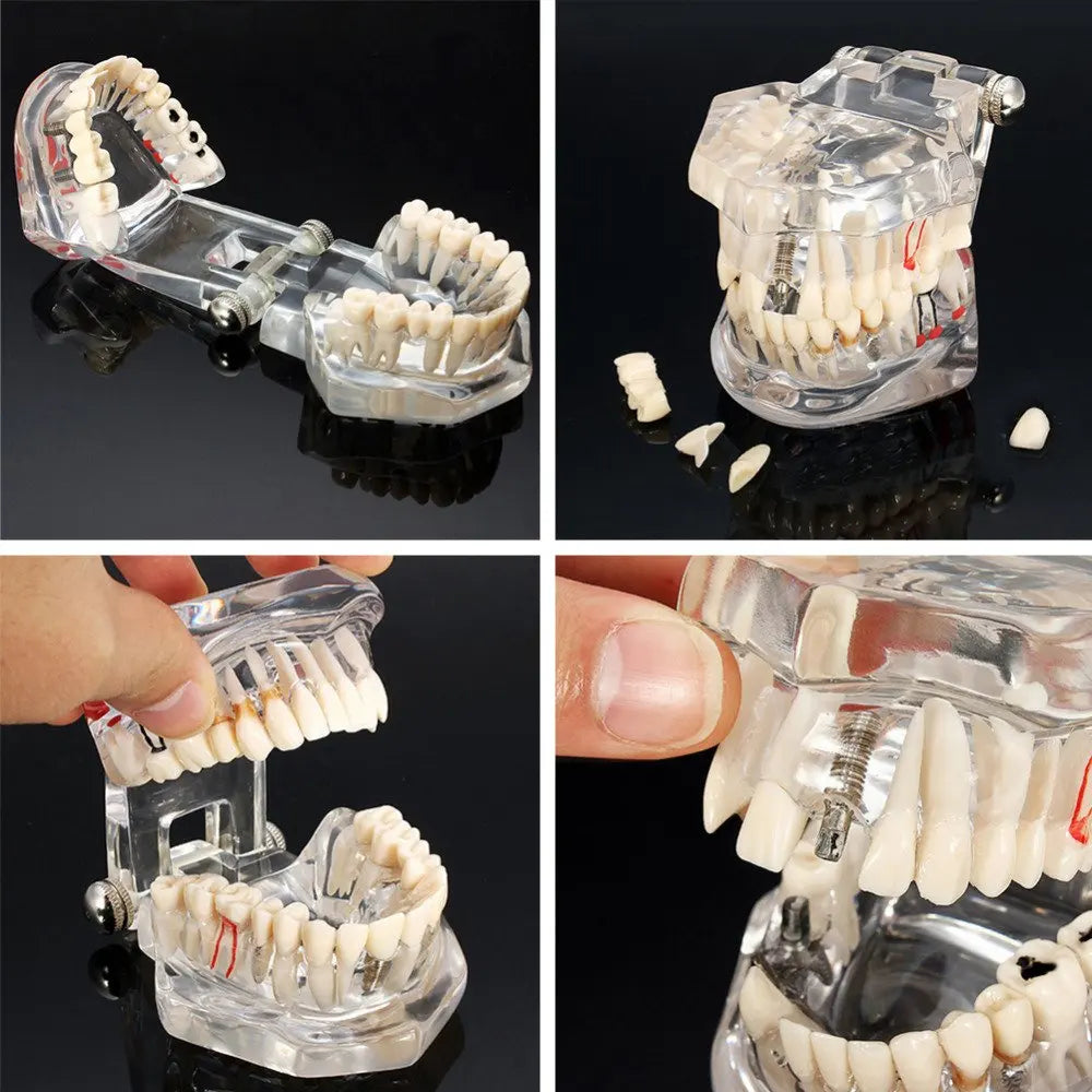 41 Styles Dental Model Teeth Teaching Model Dentist Typodont Orthodontic Jaw Model For Studying   Dentistry Products Accessories