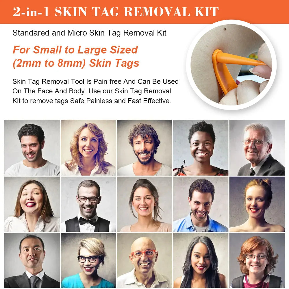 2-IN-1 Auto Skin Tag Removal Tool Kit Painless Skin Label Mole Acne Wart Removal Pen with Cleansing Swabs Facial Skin Care Tool