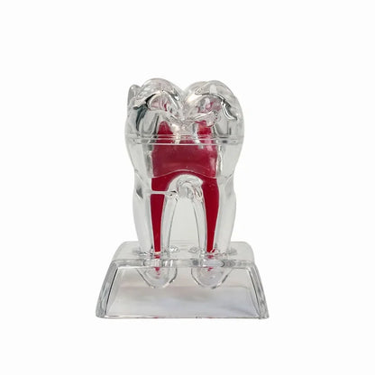 Dental Anatomical Model Transparent Luminous Detachable Single Tooth Decomposition Dentistry Clinic Ornaments 4xTeeth 70mm
