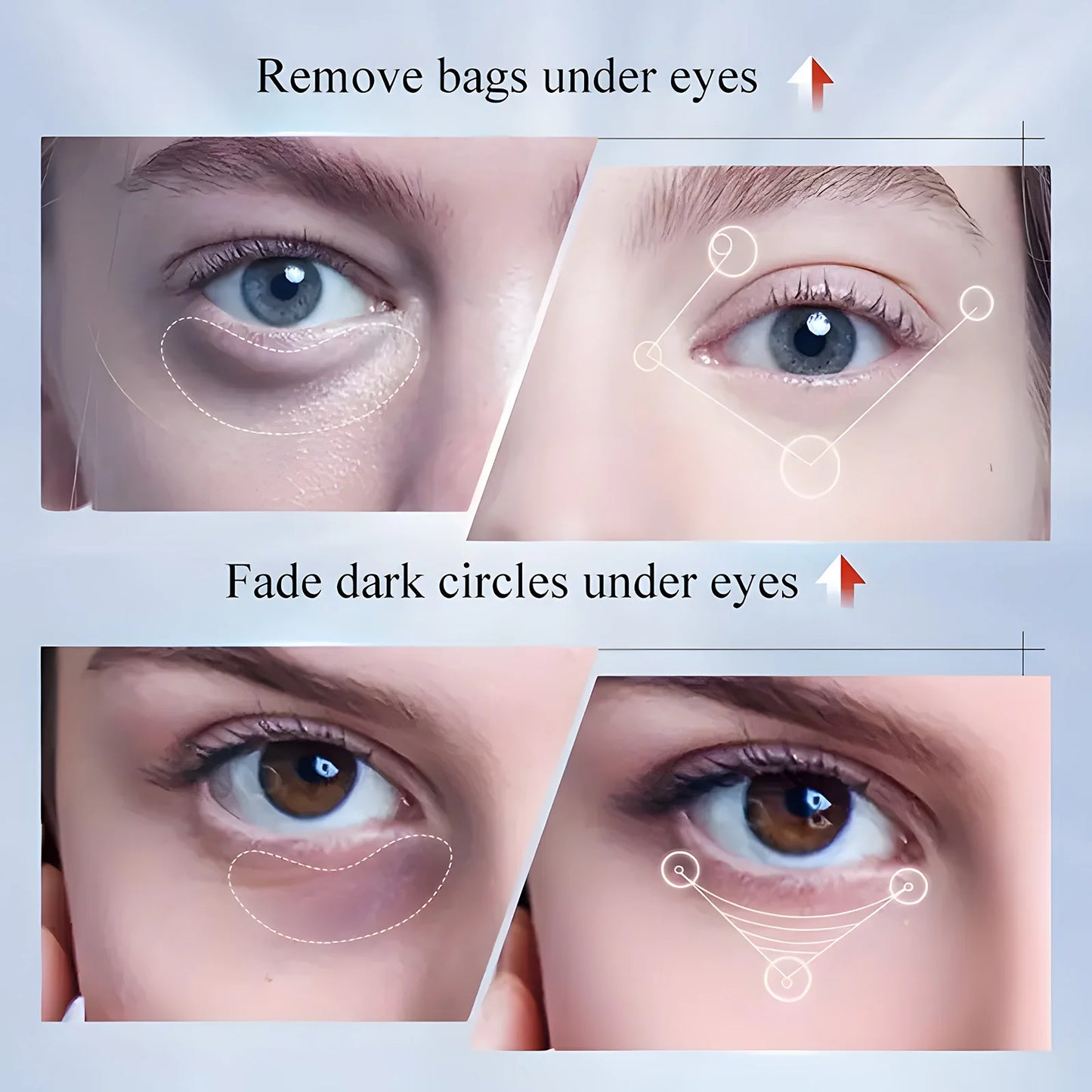 Kojic acid Eye Cream skincare Anti Dark Circles Eye Bags Firming Moisturizing skincare Eyes Cream Eyes Beauty care