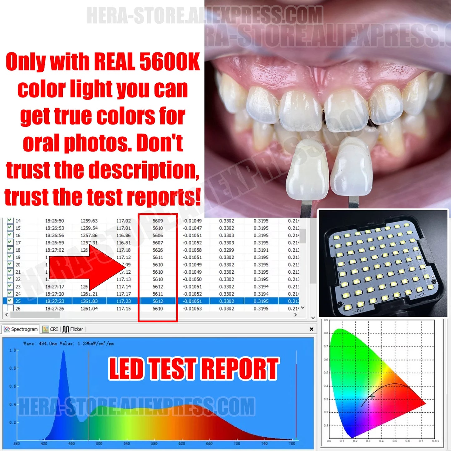 Dental Photography Kit, Mobile Phone LED Light for Dentistry Photo Video Equipment Oral Filling Light for Dentists