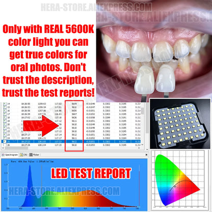 Dental Photography Kit, Mobile Phone LED Light for Dentistry Photo Video Equipment Oral Filling Light for Dentists