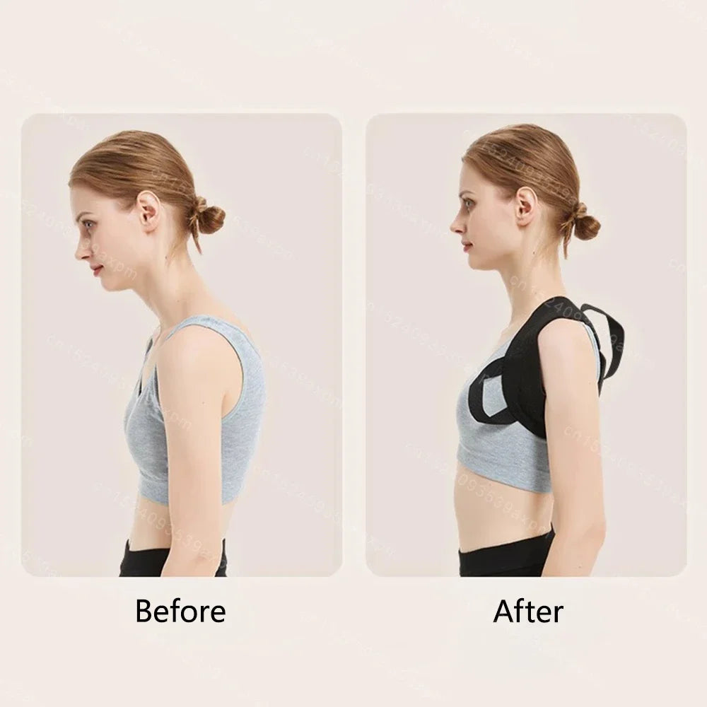 Back Brace Posture Corrector for Women and Men, Shoulder Straightener Adjustable Full Back Support Upper and Lower Pain Relief
