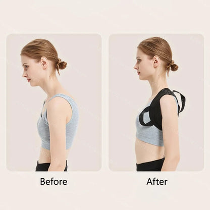 Back Brace Posture Corrector for Women and Men, Shoulder Straightener Adjustable Full Back Support Upper and Lower Pain Relief