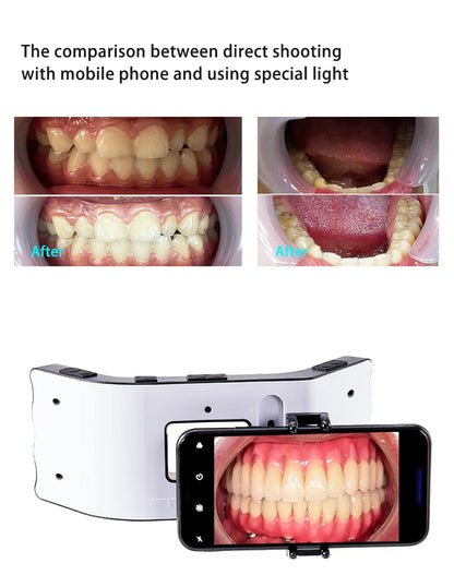 Dental Photography Light LED Oral Filling Lamp Dentistry Photo Video Orthodontics Equipment for Dentist Treatment Lighting