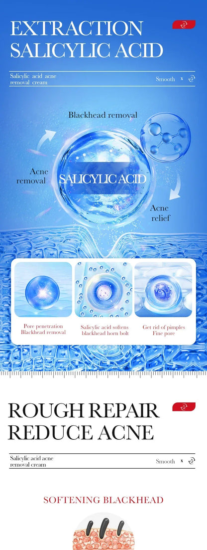 Salicylic Acid Face Cream Acne Creams Mark Repair Firming Moisturizing Blackhead Remover skincare Facial Cream