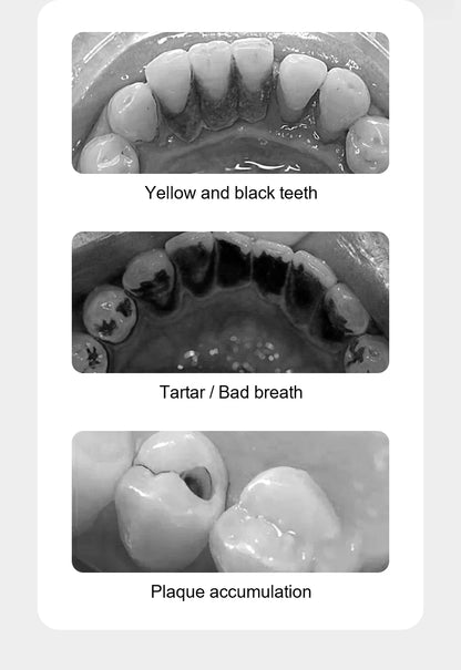 Electric Dental Scaler For Teeth 4 LED Tartar Stain Ultrasonic Tooth 1200mAh Clean Stone Health Care 4 Axis IPX7
