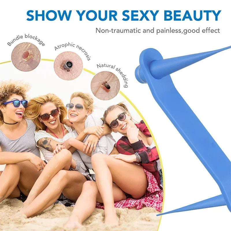 Simple Wart Removal Tool Set Skin Tag Removeal Tool Easy To Clean Skin Care Tool Skin Tag Removal Care Products