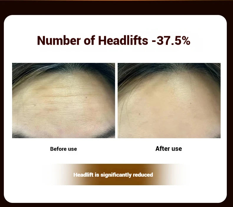 Electric Facial Roller Massager - EMS Microcurrent V-Shape Lifting Device for Face Contouring, Anti-Aging Skin Care & Hydration