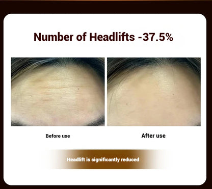 Electric Facial Roller Massager - EMS Microcurrent V-Shape Lifting Device for Face Contouring, Anti-Aging Skin Care & Hydration