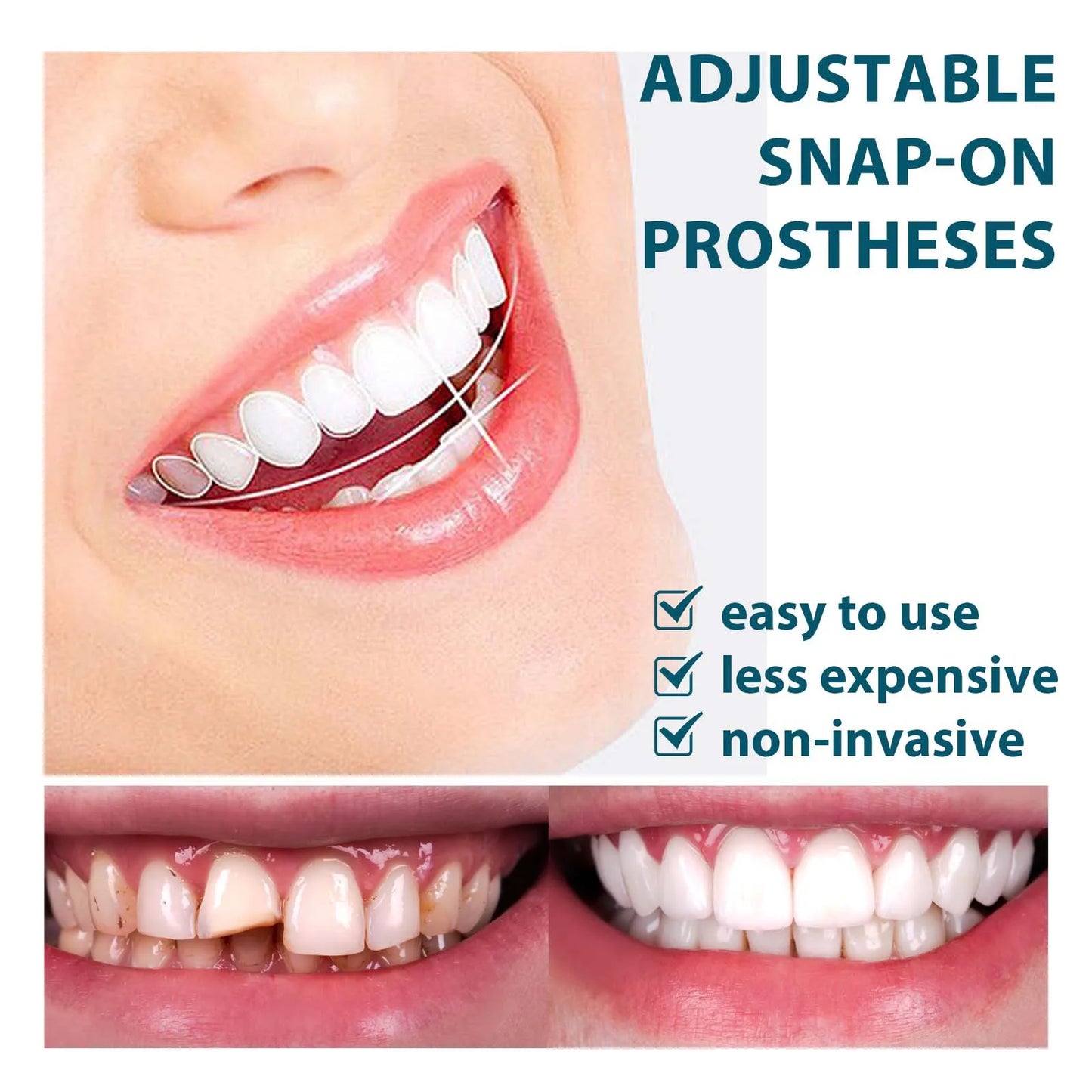 Teeth Veneers Whitening Dentures Braces Temporary False Teeth Cover Perfect Smile Comfortable Fit Denture Kit