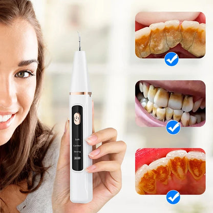 Sonic Electric Teeth Cleaner Ultrasonic Dental Scaler For Teeth Tartar Stain Dental Stone Removal Teeth Whitening Tool