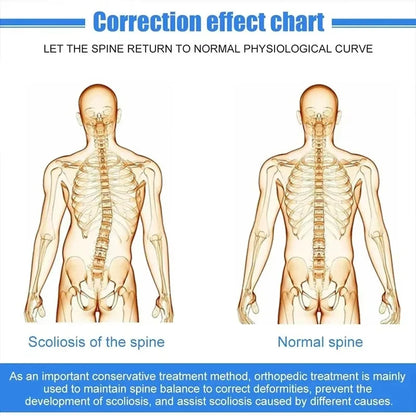 Adjustable Scoliosis Posture Corrector Adults Health Support Brace Posture Corrector Scoliosis for Back Postoperative Recovery