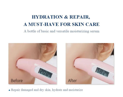 BELYN BERLY Face Serum 3Pcs/Lot Hyaluronic Acid + Vitamin C + 24k Gold Serum Moisturizing Spot White Facial Serum