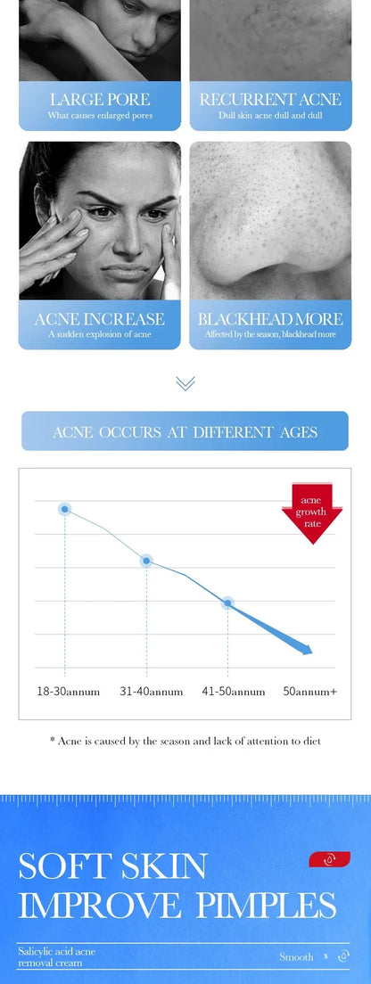 Salicylic Acid Face Cream Acne Creams Mark Repair Firming Moisturizing Blackhead Remover skincare Facial Cream