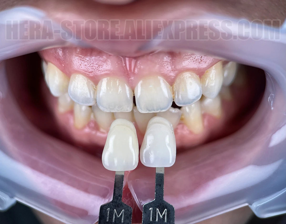 Dental Photography Kit, Mobile Phone LED Light for Dentistry Photo Video Equipment Oral Filling Light for Dentists