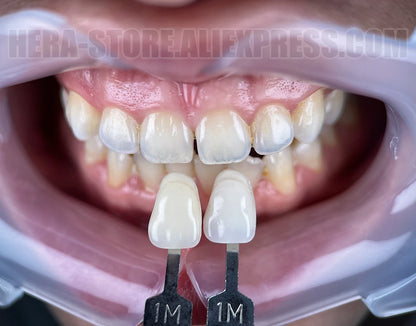 Dental Photography Kit, Mobile Phone LED Light for Dentistry Photo Video Equipment Oral Filling Light for Dentists