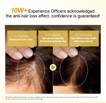 PURC Ginger Hair Serum for Men Women Scalp Treatment Repair Damaged Dry Moisturizing Hair Care Products 50ml