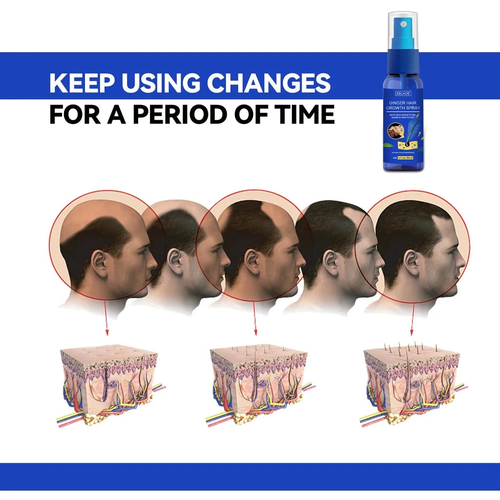 Ginger Hair Growth spray Anti Hair Fall Hair Loss Treatment Hair Growth Essence Oil for Men Women hair treatment