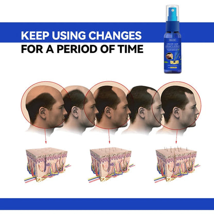 Ginger Hair Growth spray Anti Hair Fall Hair Loss Treatment Hair Growth Essence Oil for Men Women hair treatment