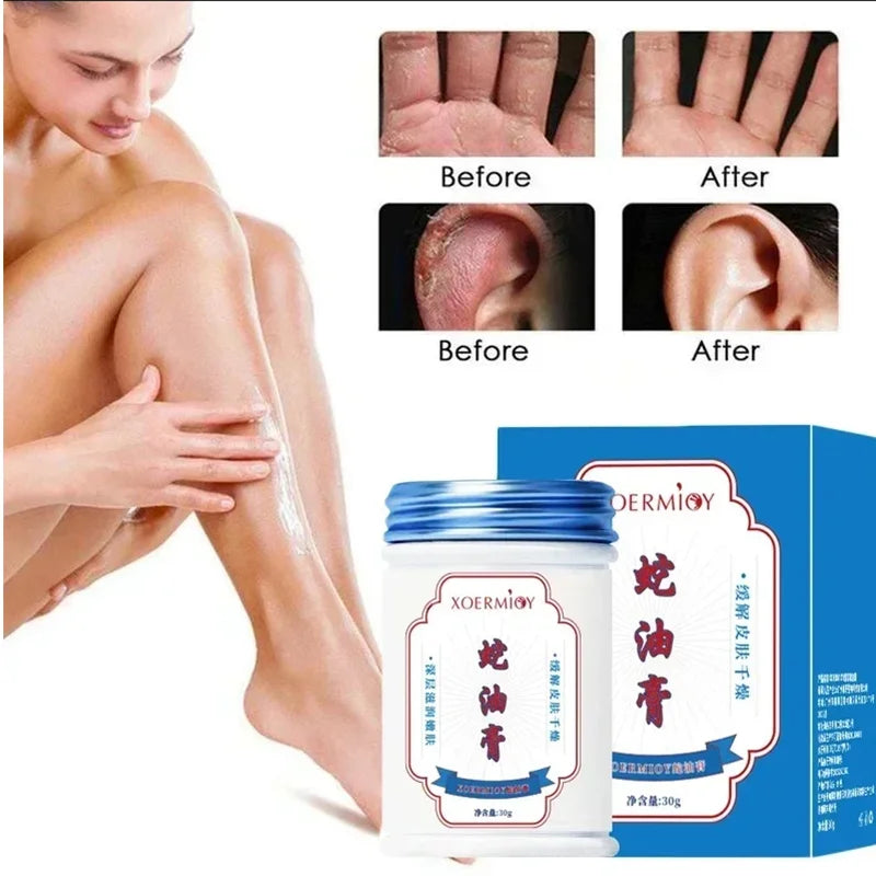 30g Body Care Cream Effectively Relieve Dry Skin Moisturizing Oil Herbal Smooth Tender Skin Body Care Foot Hydrating Care Cream