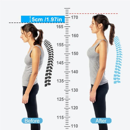 Smart Back Posture Corrector Spine Clavicle Brace Support Belt Vibration Shoulder Training Adjustable Adult Child Strap Health
