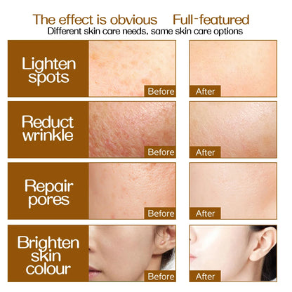 Professional 540 Needles for Facial Body Hair Growth Derma Roller for Skin Beard 0.2mm 0.25mm 0.3mm Needle Beauty Roller