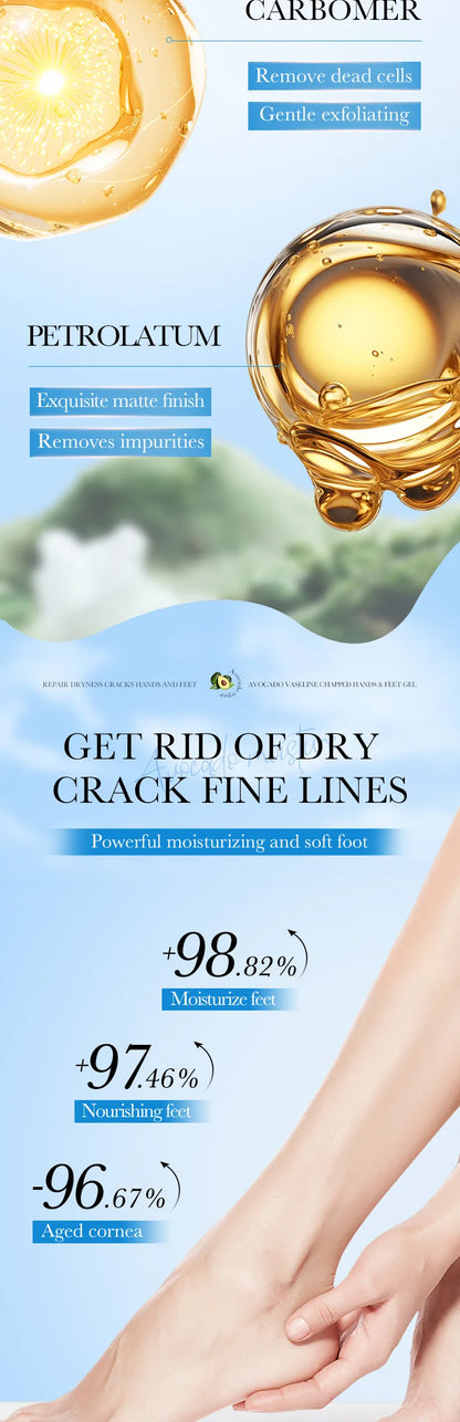 Avocado Hand and Foot Cream Condensation Bead Rolling Creams Moisturizing Nourishing Repairing Feet Hands skincare Creams