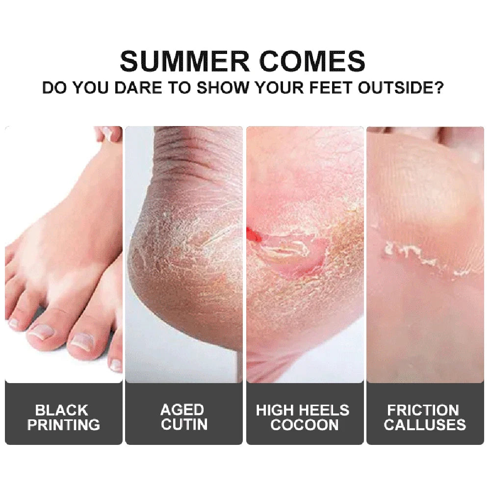 2-10pair Exfoliating Foot Mask Foot Care Tools For Remove Dead Skin Calluses Heel Crack Repair Pedicure Socks Foot Skin Care