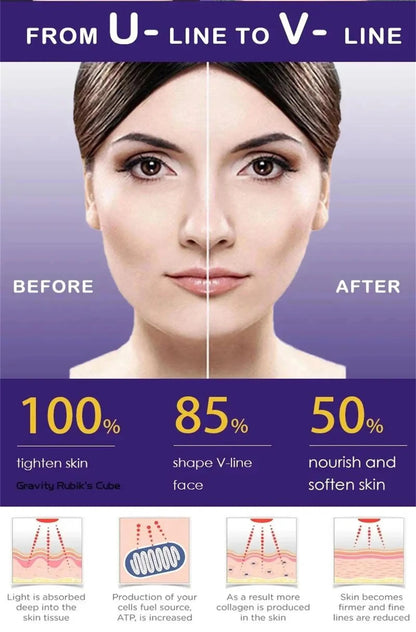 Roller Massager V-Shape Firming Face-lift Slimming Cream Removal Masseter Muscle Double Chin Face Fat Burning Anti-aging Product