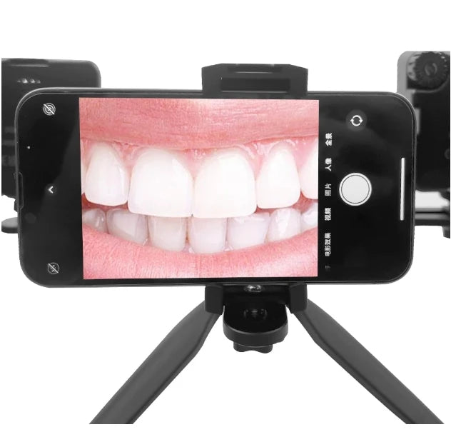 Dental Photography Equipment LED 2 In 1 Oral Filling Lamp Orthodontics Flash Light for Dentist Photo Fill Intraoral light