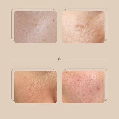 Beauty Rice Honey Facial Skincare 3pieces Set Moisturizing Arbutin Serum Milk Toner Smear Glow Mask Korean Brand Facial Skincare