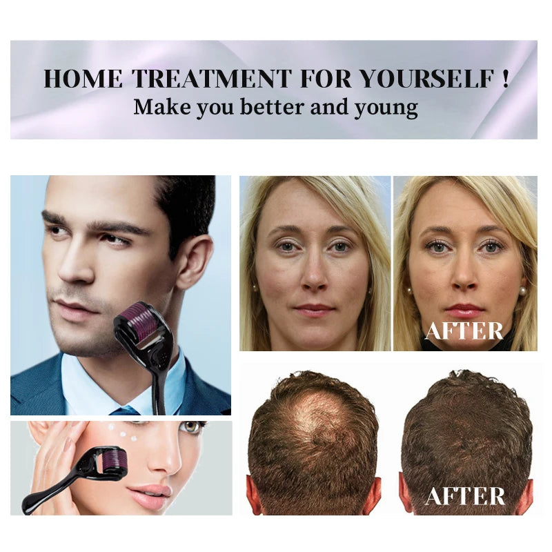 540 Needles for Facial Body Hair Growth Derma Roller for Skin Beard  0.2mm 0.25mm 0.3mm Skin Care Treatment Microneedle