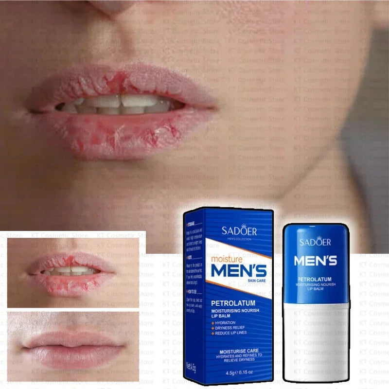 Men Lip Balm Moisturizing Hydration Fading Lip Lines Anti-Cracking Remove Dead Skin Refreshing And Not Greasy Exquisite Lip Care