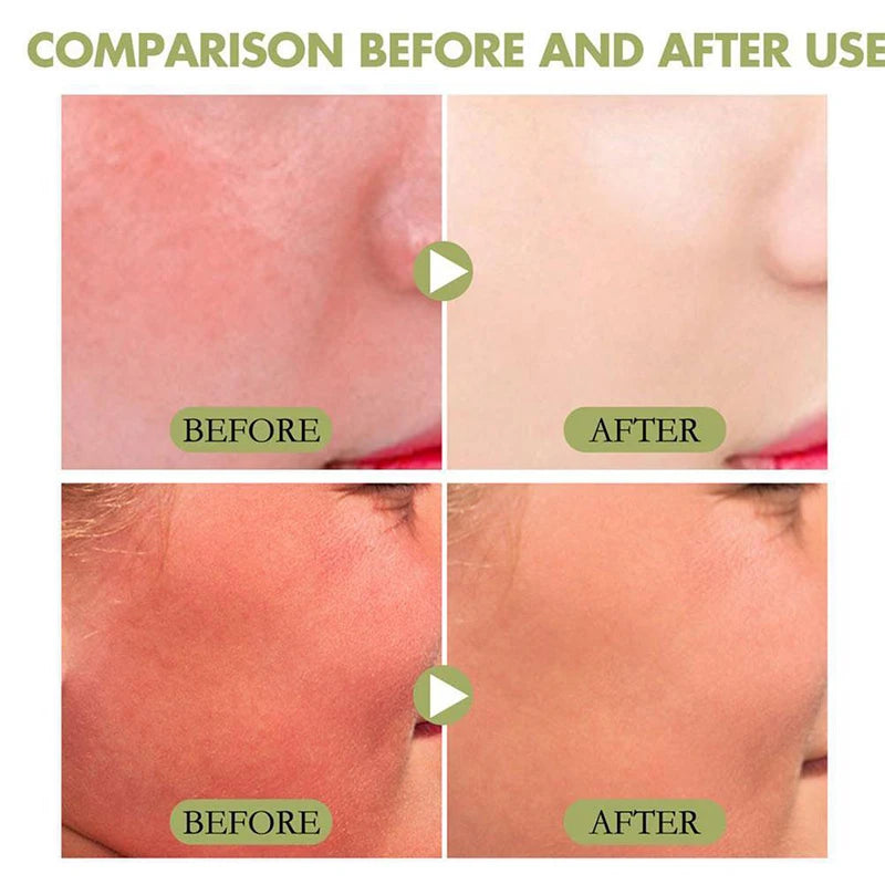 Beauty Rice Honey Facial Skincare 3pieces Set Moisturizing Arbutin Serum Milk Toner Smear Glow Mask Korean Brand Facial Skincare