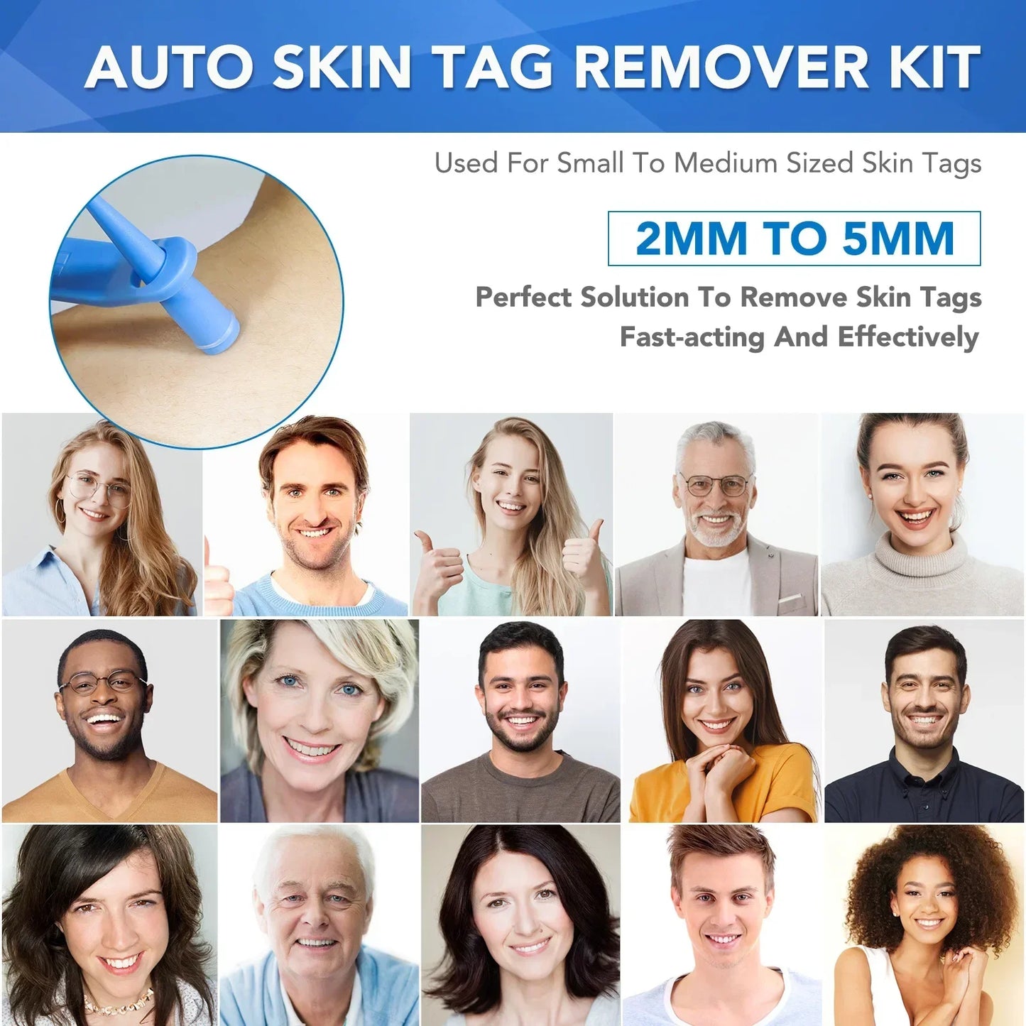 Simple Wart Removal Tool Set Skin Tag Removeal Tool Easy To Clean Skin Care Tool Skin Tag Removal Care Products