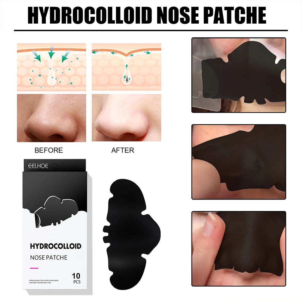 10 Pieces Nose Patch Hydrocolloid Skin Pimple Patches Blackheads Pad